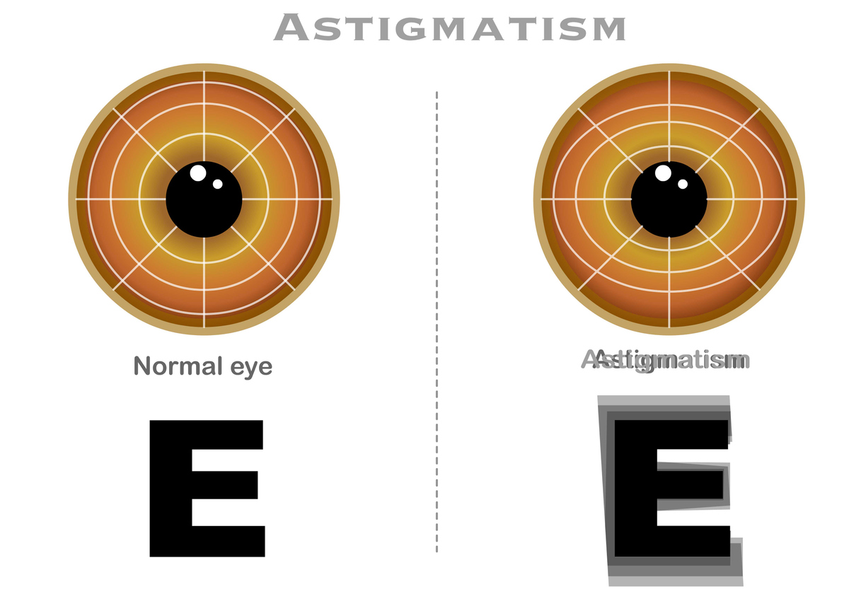 Astigmatism vs. Neasitedness, An eye test diagram